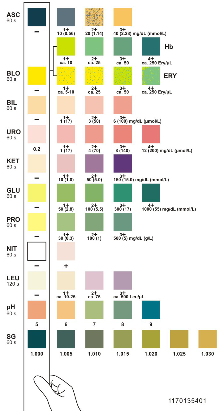 Siemens Urine Test Chart